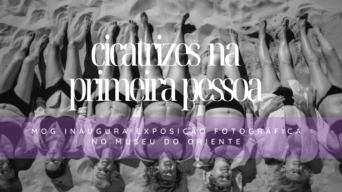 Uma exposição fotográfica que transforma marcas de dor em símbolos de superação.